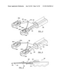 Soft Tissue Repair Device and Associated Methods diagram and image