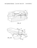 Soft Tissue Repair Device and Associated Methods diagram and image