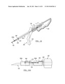 Soft Tissue Repair Device and Associated Methods diagram and image