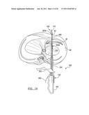 Soft Tissue Repair Device and Associated Methods diagram and image