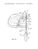 Soft Tissue Repair Device and Associated Methods diagram and image