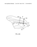 Soft Tissue Repair Device and Associated Methods diagram and image