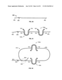 Soft Tissue Repair Device and Associated Methods diagram and image