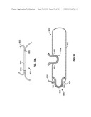 Soft Tissue Repair Device and Associated Methods diagram and image