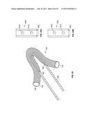 Soft Tissue Repair Device and Associated Methods diagram and image