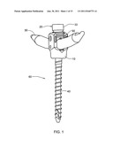 Locking Device And Method Employing A Posted Member To Control Positioning     Of A Stabilization Member Of A Bone Stabilization System diagram and image