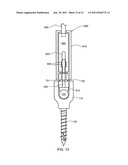 Locking Device And Method Employing A Posted Member To Control Positioning     Of A Stabilization Member Of A Bone Stabilization System diagram and image