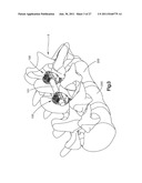 BONE FIXATION ASSEMBLY diagram and image