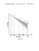 Modulation of AV Delay to Control Ventricular Interval Variability diagram and image