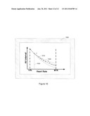 Modulation of AV Delay to Control Ventricular Interval Variability diagram and image