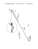 Obstructive Sleep Apnea Treatment Devices, Systems and Methods diagram and image