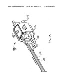 Obstructive Sleep Apnea Treatment Devices, Systems and Methods diagram and image