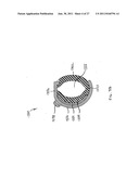 Obstructive Sleep Apnea Treatment Devices, Systems and Methods diagram and image