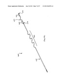 Obstructive Sleep Apnea Treatment Devices, Systems and Methods diagram and image