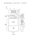 Obstructive Sleep Apnea Treatment Devices, Systems and Methods diagram and image