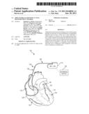 IMPLANTABLE LEADS WITH AN AXIAL REINFORCEMENT MEMBER diagram and image