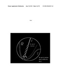 METHOD FOR DETERMINING HEAT BOUNDARY VALUE CONDITIONS OF RED BLOOD CELLS     IN THE NEIGHBORHOOD OF MYOCARDIUM diagram and image