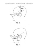 Nasal Assembly diagram and image