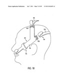 Nasal Assembly diagram and image