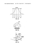 Nasal Assembly diagram and image