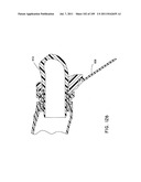 Nasal Assembly diagram and image