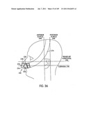 Nasal Assembly diagram and image