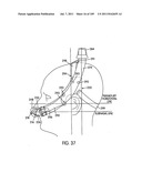 Nasal Assembly diagram and image