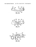 Nasal Assembly diagram and image