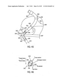 Nasal Assembly diagram and image