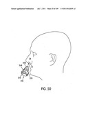 Nasal Assembly diagram and image