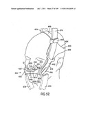 Nasal Assembly diagram and image