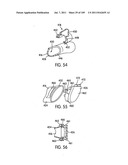 Nasal Assembly diagram and image