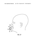 Nasal Assembly diagram and image