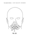 Nasal Assembly diagram and image