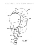 Nasal Assembly diagram and image