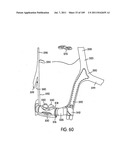 Nasal Assembly diagram and image