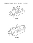 Nasal Assembly diagram and image