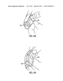 Nasal Assembly diagram and image