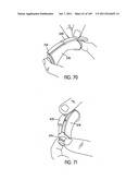 Nasal Assembly diagram and image