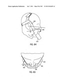 Nasal Assembly diagram and image
