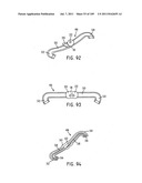 Nasal Assembly diagram and image