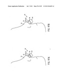 Nasal Assembly diagram and image