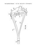 Nasal Assembly diagram and image