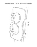 Nasal Assembly diagram and image