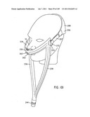 Nasal Assembly diagram and image