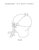 Nasal Assembly diagram and image