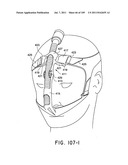 Nasal Assembly diagram and image