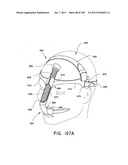 Nasal Assembly diagram and image