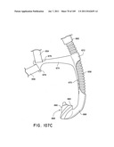 Nasal Assembly diagram and image