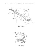 Nasal Assembly diagram and image